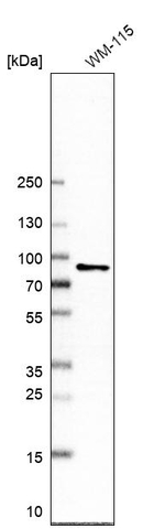 Radixin Antibody in Western Blot (WB)