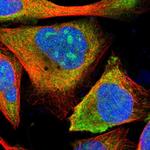 ETV6 Polyclonal Antibody