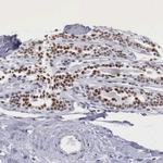 ETV6 Antibody in Immunohistochemistry (Paraffin) (IHC (P))