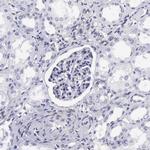 ETV6 Antibody in Immunohistochemistry (Paraffin) (IHC (P))