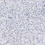 ETV6 Antibody in Immunohistochemistry (Paraffin) (IHC (P))