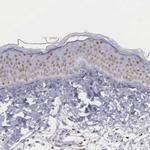 ETV6 Antibody in Immunohistochemistry (Paraffin) (IHC (P))