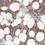 GAB2 Antibody in Immunohistochemistry (Paraffin) (IHC (P))