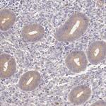 GAB2 Antibody in Immunohistochemistry (Paraffin) (IHC (P))