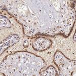 GAB2 Antibody in Immunohistochemistry (Paraffin) (IHC (P))