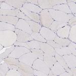 GAB2 Antibody in Immunohistochemistry (Paraffin) (IHC (P))