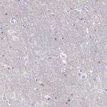 CD204 Antibody in Immunohistochemistry (Paraffin) (IHC (P))