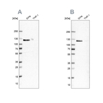 UBE1 Antibody in Western Blot (WB)