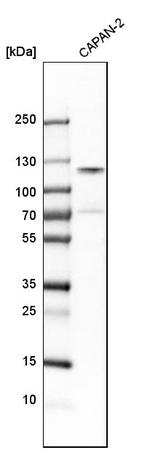 CTAGE5 Antibody in Western Blot (WB)