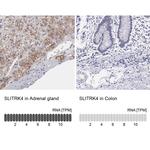 SLITRK4 Antibody