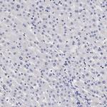 SLITRK4 Antibody in Immunohistochemistry (Paraffin) (IHC (P))