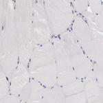 SLITRK4 Antibody in Immunohistochemistry (Paraffin) (IHC (P))