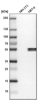 Cytokeratin 17 Antibody in Western Blot (WB)