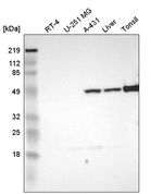Thymidine Phosphorylase Antibody in Western Blot (WB)