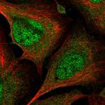 CrkL Polyclonal Antibody