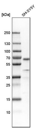 SOX11 Antibody in Western Blot (WB)