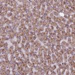 AMMECR1 Antibody in Immunohistochemistry (Paraffin) (IHC (P))