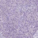 AMMECR1 Antibody in Immunohistochemistry (Paraffin) (IHC (P))
