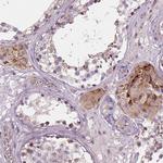 AMMECR1 Antibody in Immunohistochemistry (Paraffin) (IHC (P))