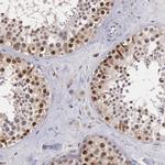 Cdc45L Antibody in Immunohistochemistry (Paraffin) (IHC (P))