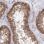 GRASP1 Antibody in Immunohistochemistry (Paraffin) (IHC (P))