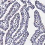 HMOX1 Antibody in Immunohistochemistry (Paraffin) (IHC (P))