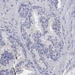 HMOX1 Antibody in Immunohistochemistry (Paraffin) (IHC (P))
