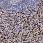 HMOX1 Polyclonal Antibody