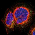 ARFGAP3 Antibody in Immunocytochemistry (ICC/IF)