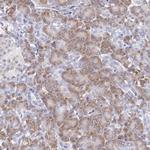 ARFGAP3 Antibody in Immunohistochemistry (Paraffin) (IHC (P))