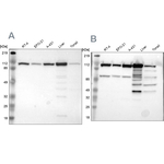 MTHFD1 Antibody in Western Blot (WB)