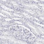 SH3BP1 Antibody in Immunohistochemistry (Paraffin) (IHC (P))