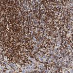 SH3BP1 Antibody in Immunohistochemistry (Paraffin) (IHC (P))