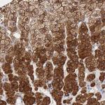 Radixin Antibody in Immunohistochemistry (Paraffin) (IHC (P))