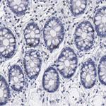 Radixin Antibody in Immunohistochemistry (Paraffin) (IHC (P))