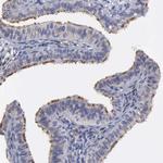 Radixin Antibody in Immunohistochemistry (Paraffin) (IHC (P))