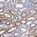 Radixin Antibody in Immunohistochemistry (Paraffin) (IHC (P))