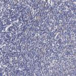 Radixin Antibody in Immunohistochemistry (Paraffin) (IHC (P))