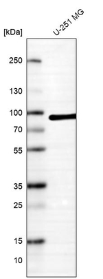 Radixin Antibody in Western Blot (WB)