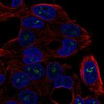 ICK Polyclonal Antibody