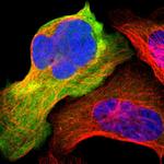 ENO3 Polyclonal Antibody