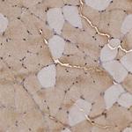 ENO3 Antibody in Immunohistochemistry (Paraffin) (IHC (P))