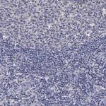 ENO3 Antibody in Immunohistochemistry (Paraffin) (IHC (P))