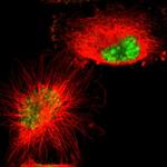 GRK3 Polyclonal Antibody