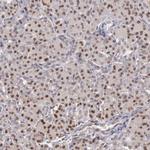 GRK3 Antibody in Immunohistochemistry (Paraffin) (IHC (P))