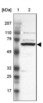 GRK3 Antibody in Western Blot (WB)