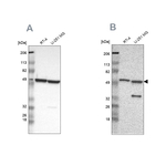 G6PD Antibody in Western Blot (WB)