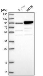 MCM5 Antibody in Western Blot (WB)