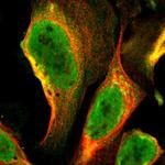 GTF2A1 Polyclonal Antibody