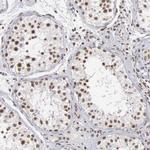 GTF2A1 Antibody in Immunohistochemistry (Paraffin) (IHC (P))